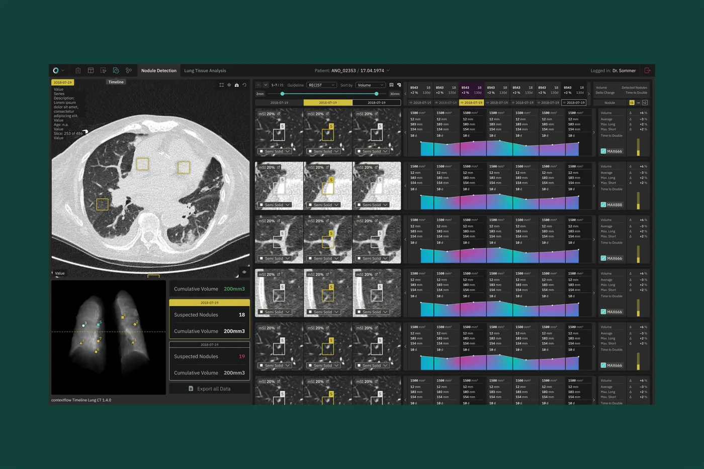 Lung CT viewer in the contextflow colors, tracking nodules across scans
