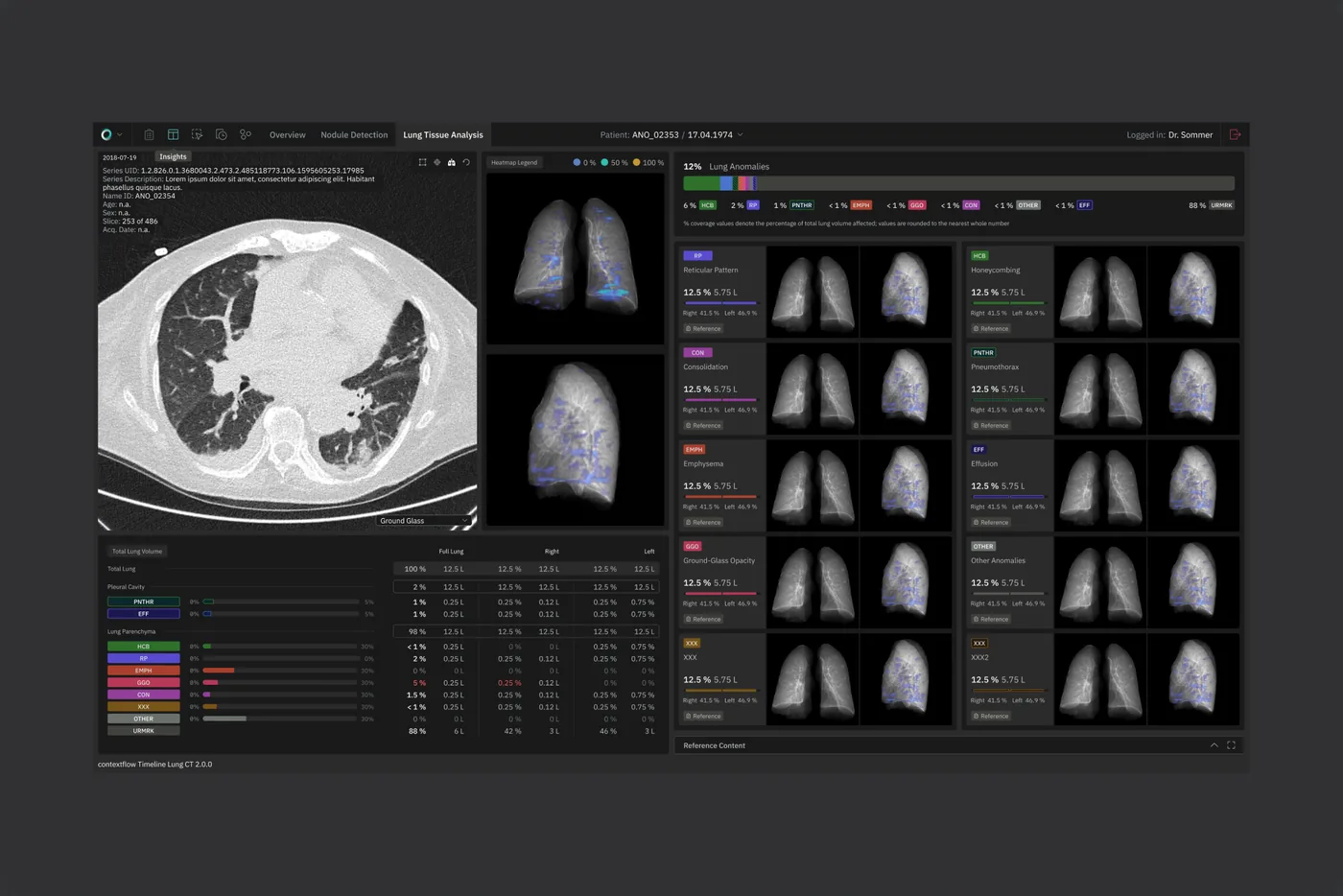 Dark CT reading view with series thumbnails and a findings table