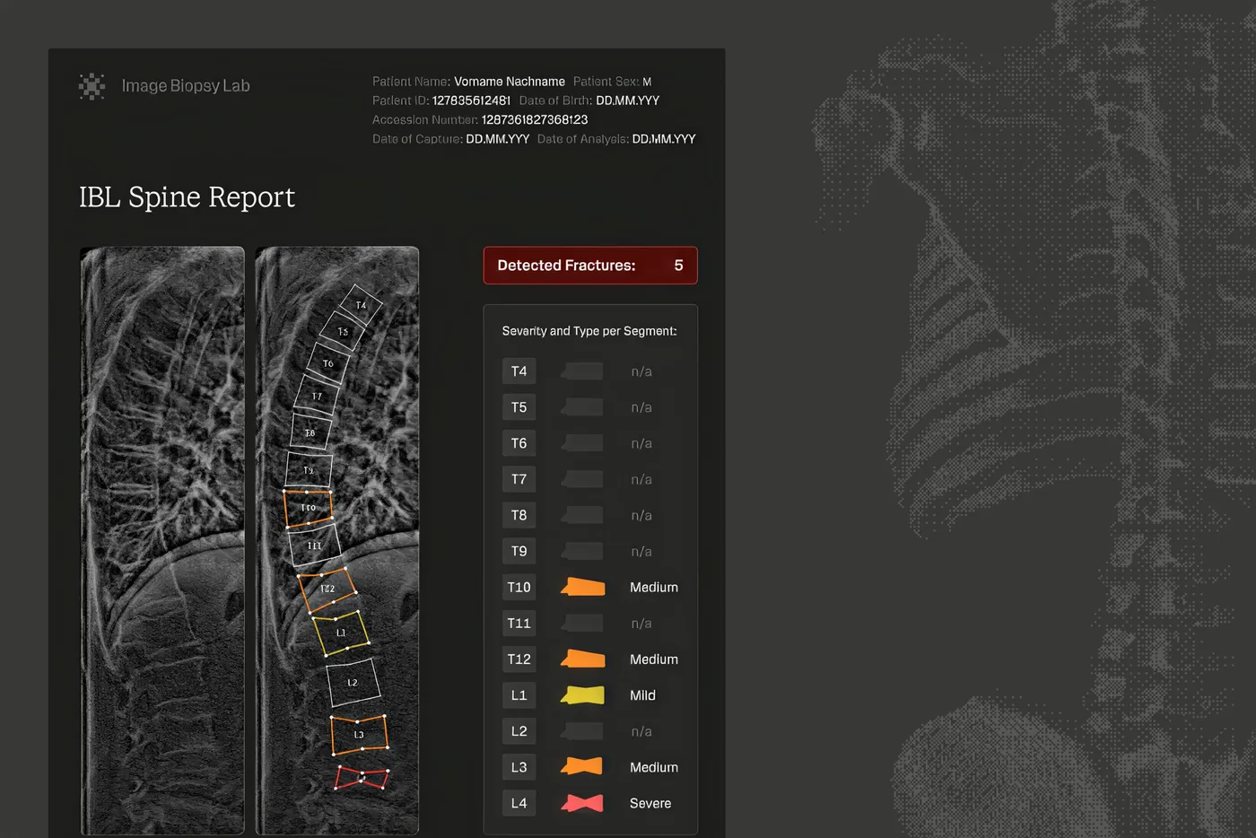 IBL Spine Report with measurements